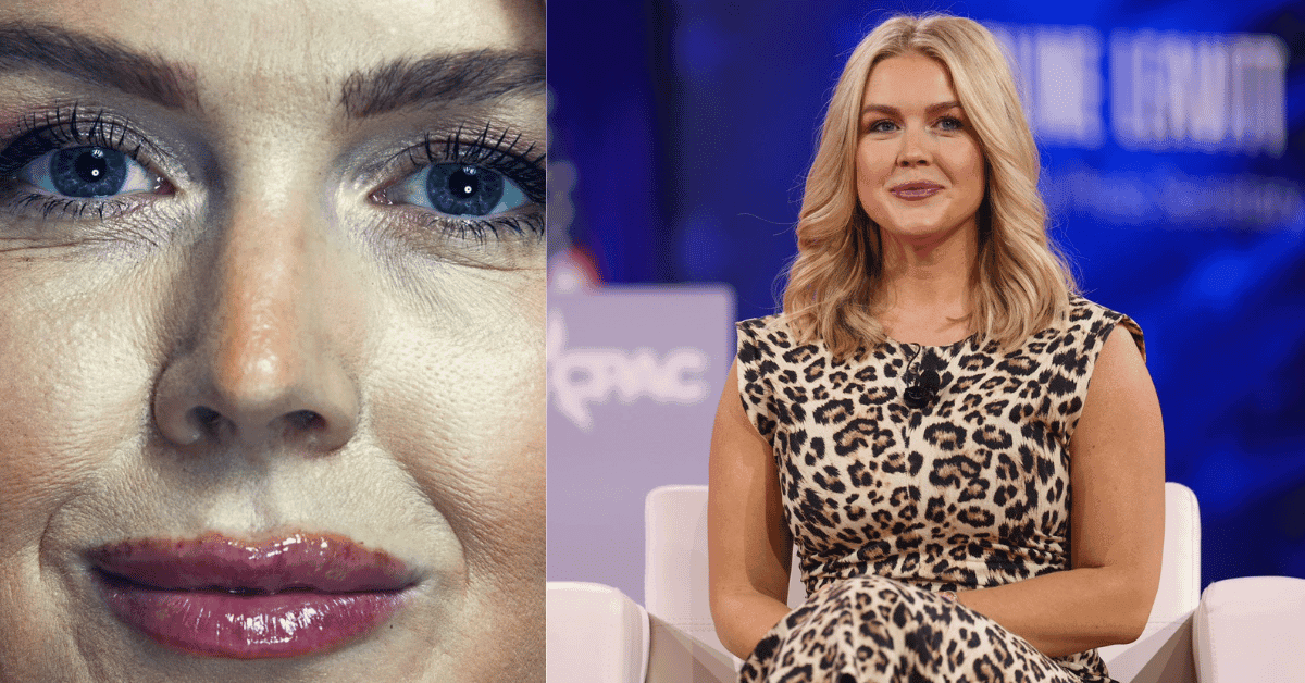 Beauty Experts Explain Why Karoline Leavitt’s Close-Up Photo Sparked a Frenzy